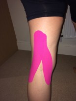 Very pretty strapping for the mystery knee niggle